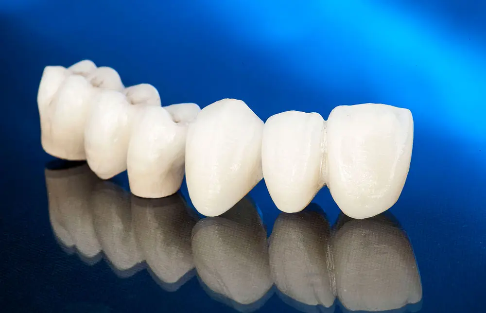 Dr Dimitrije Stojanović Dental Clinic Cirkonijum keramika