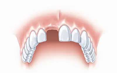 Dr Dimitrije Stojanović Dental Clinic Implanti